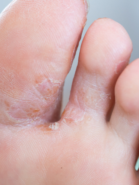 Banner Site (450 x 600) - Silvia Feet (1)